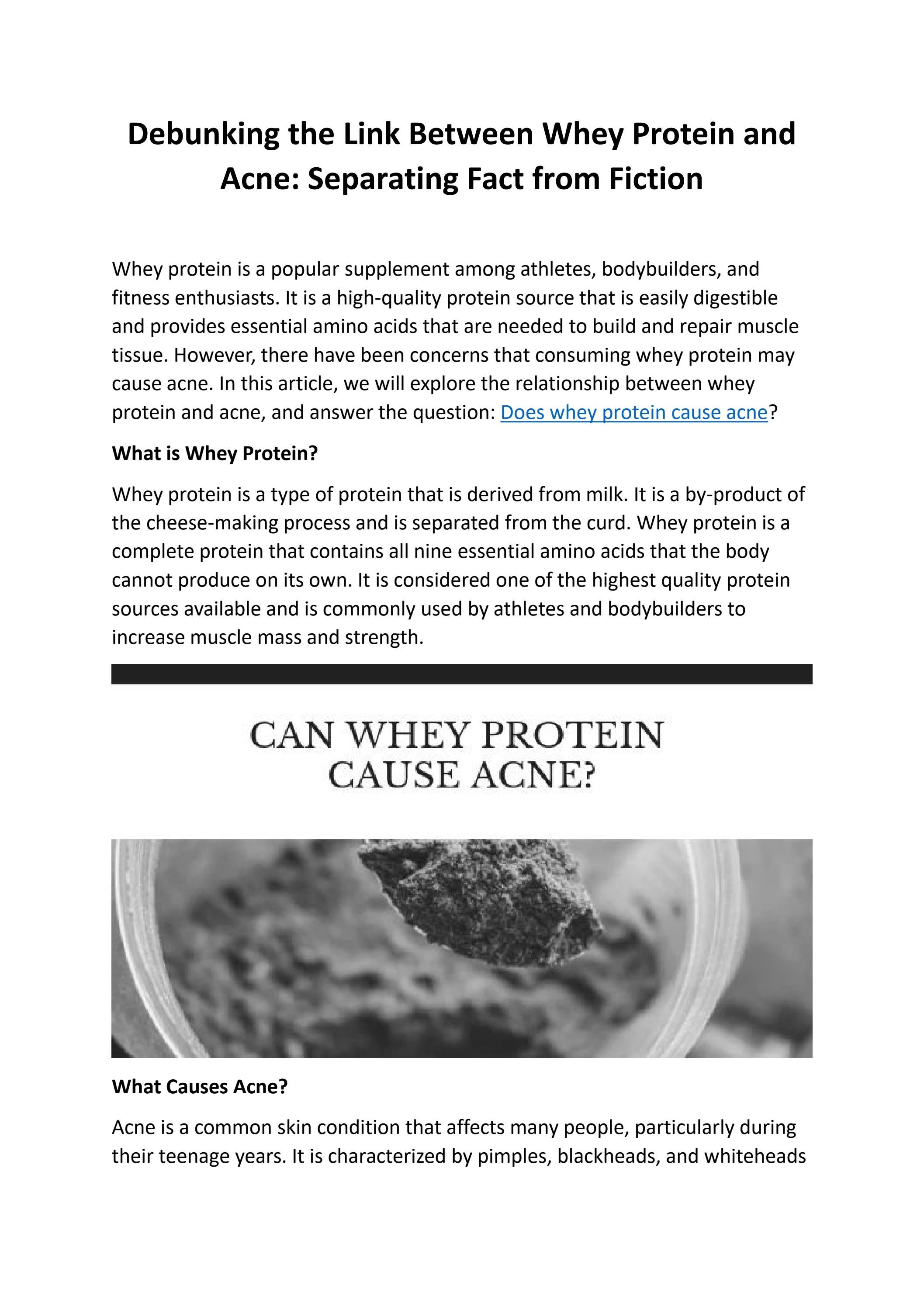 Debunking the Link Between Whey Protein and Acne Separating Fact from