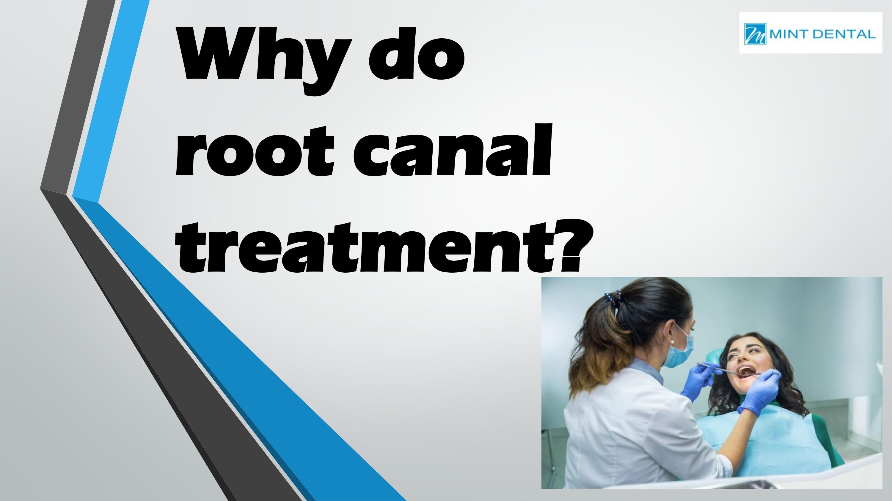 Why do root canal treatment? by Mint Dental Issuu