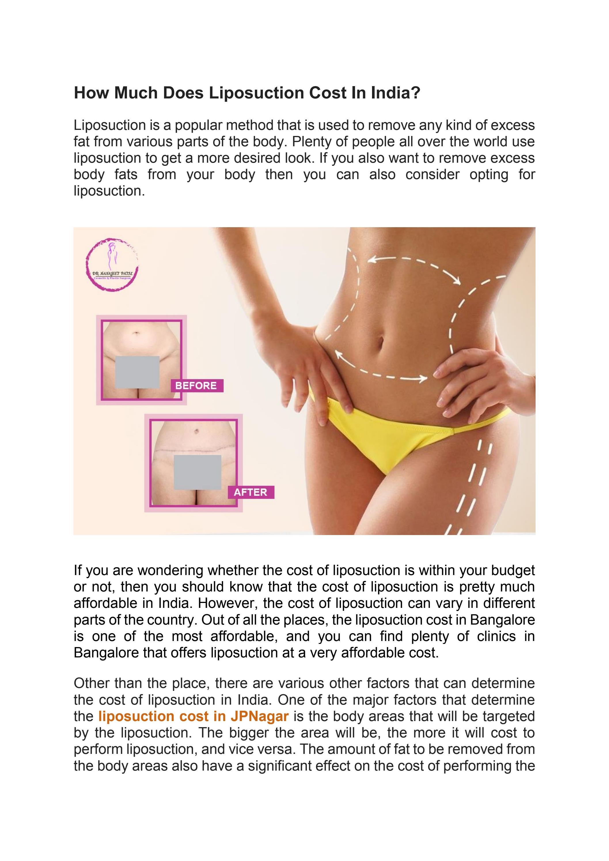 How Much Does Liposuction Cost In India? by drmanajeetpatil Issuu