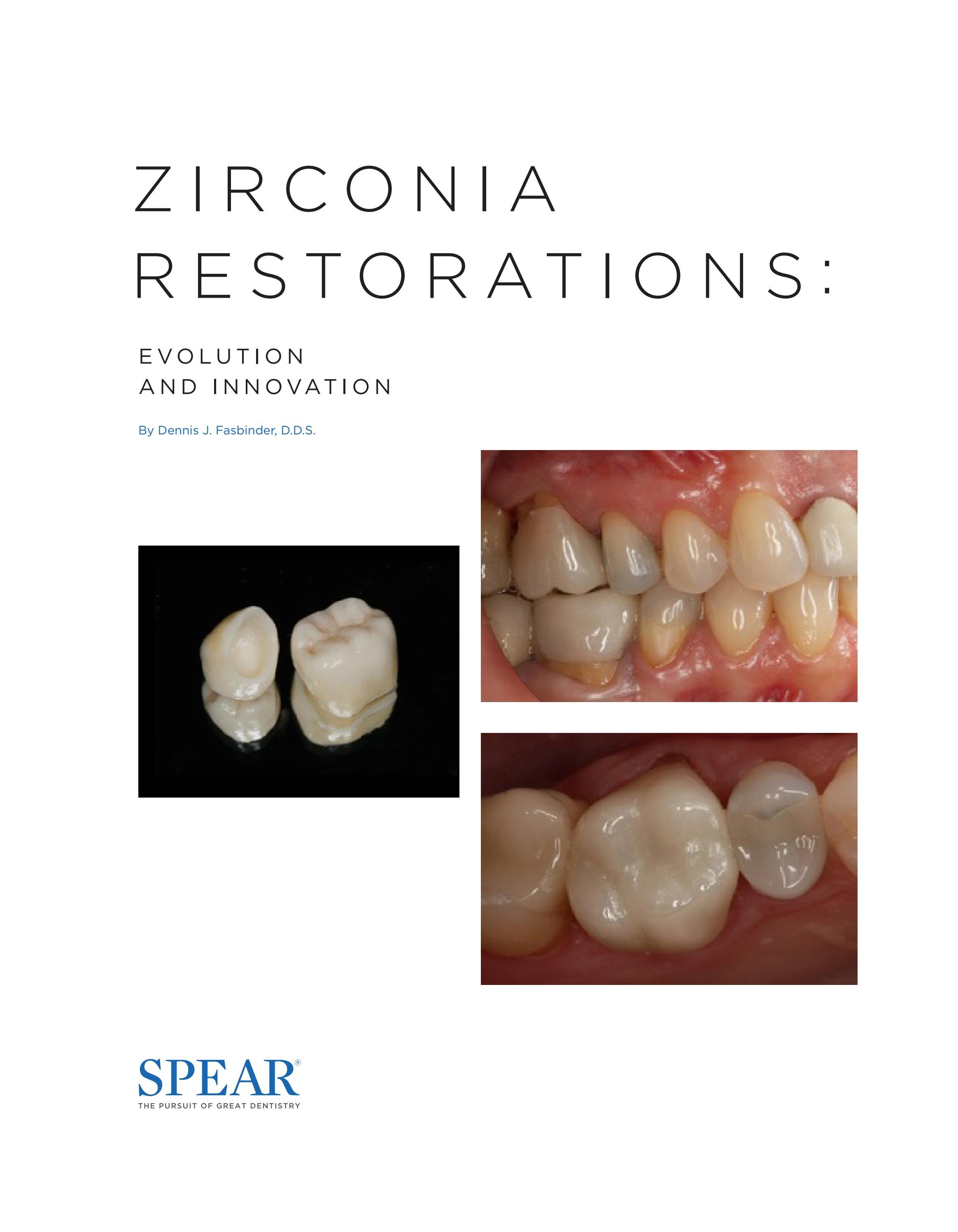 Spear's Whitepaper Zirconia Restorations Evolution and Innovation by