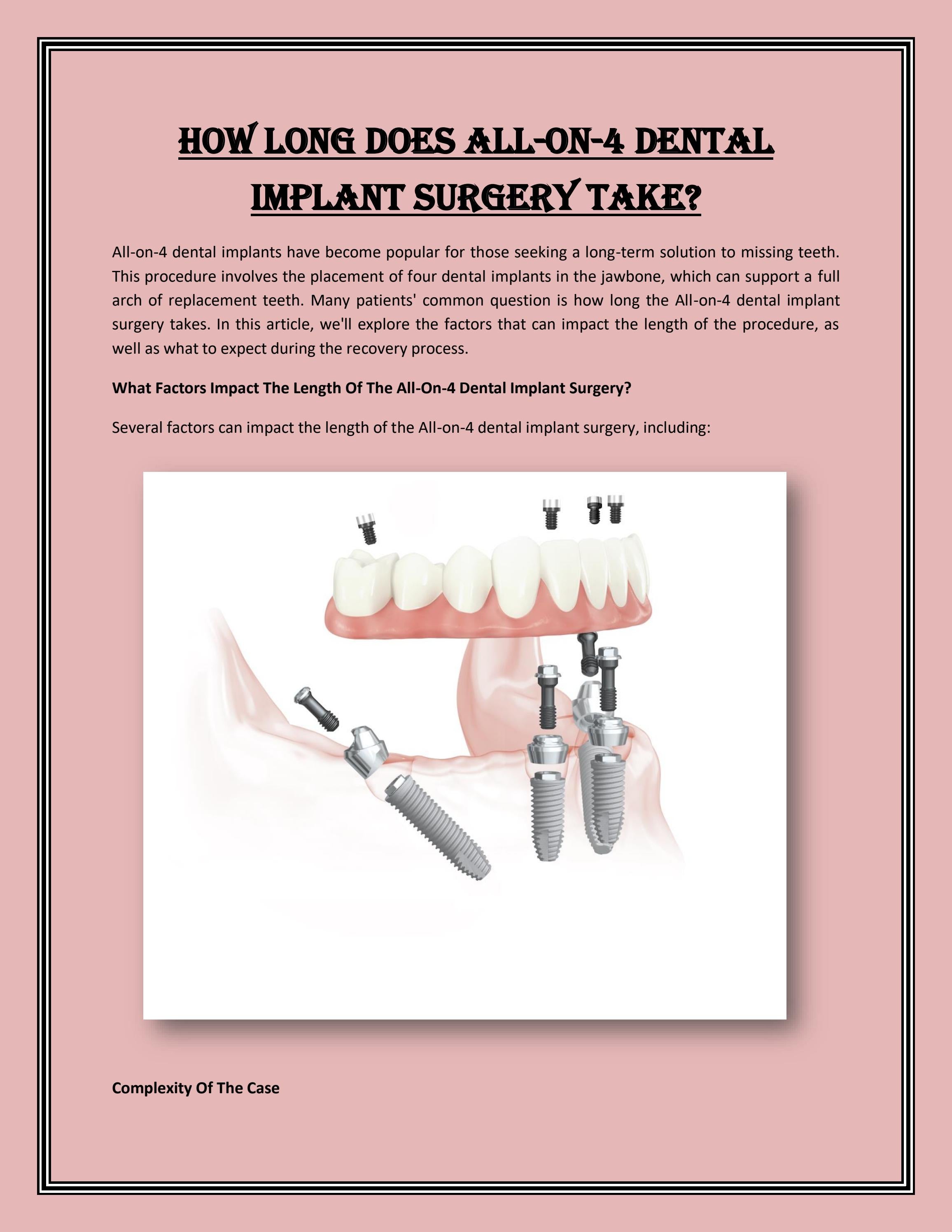 How Long Does AllOn4 Dental Implant Surgery Take? by Nextsmile Blog Issuu