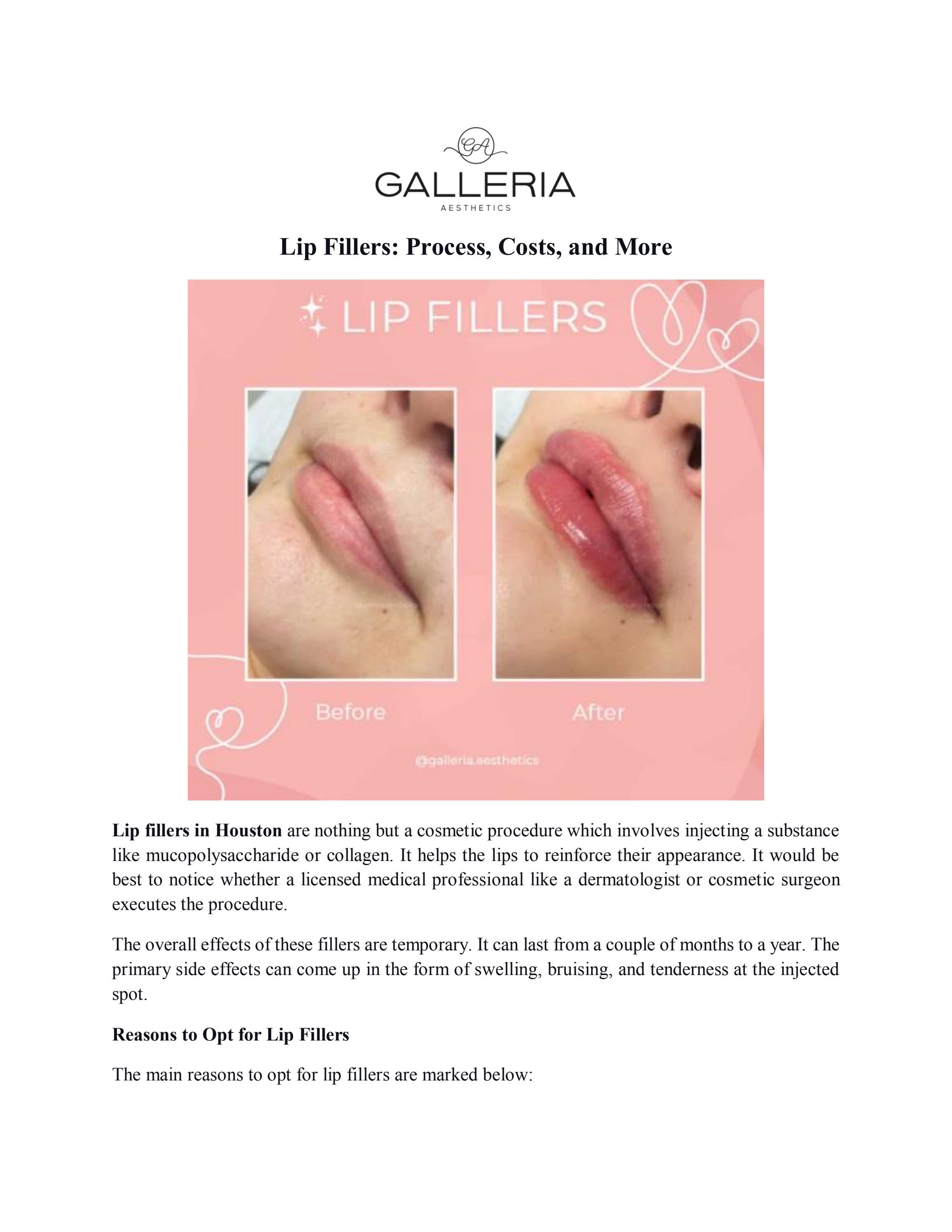 Lip Fillers Process, Costs, and More by AnnaEngerRitch Issuu
