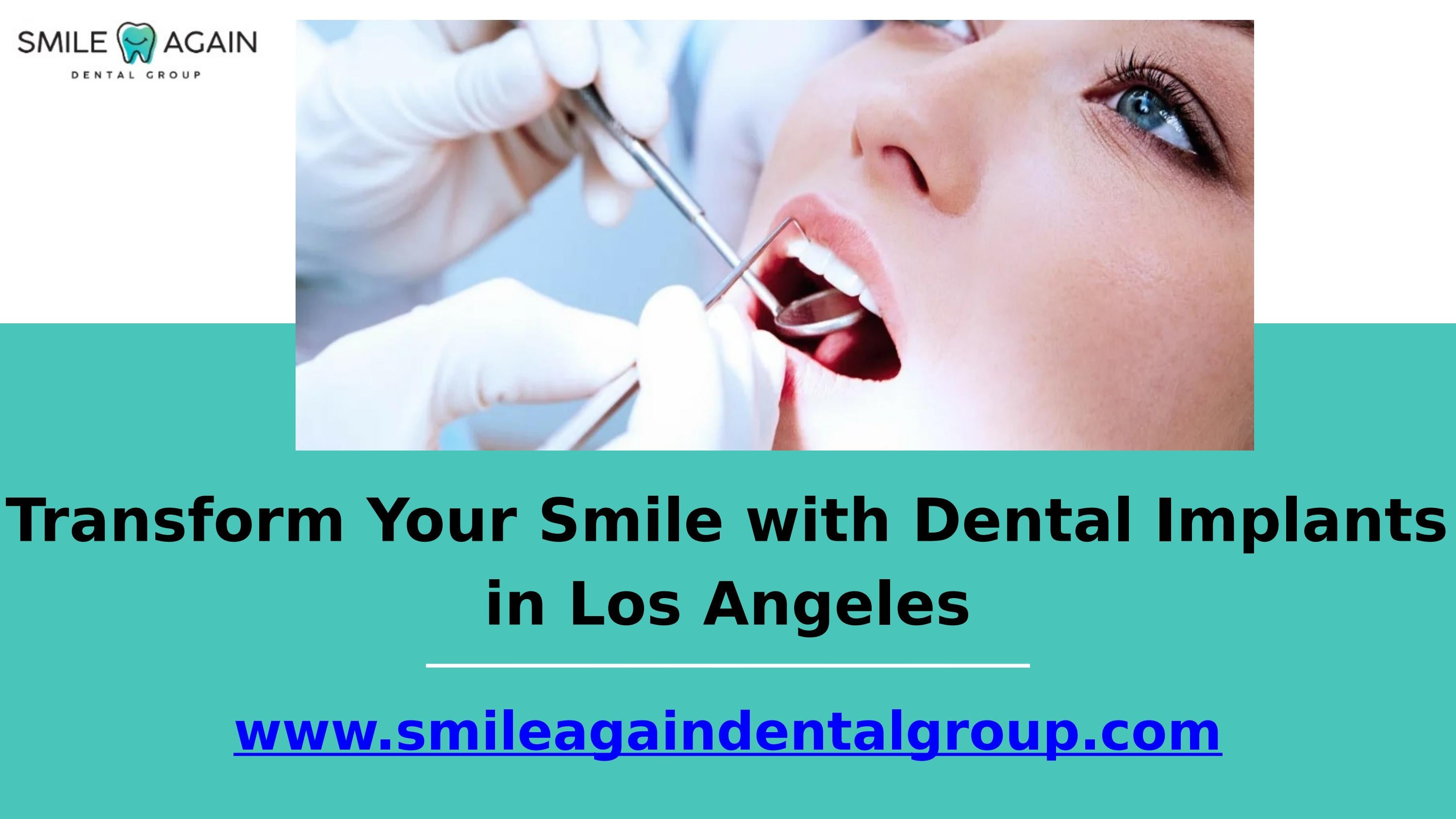 Transform Your Smile with Dental Implants in Los Angeles by Smile Again