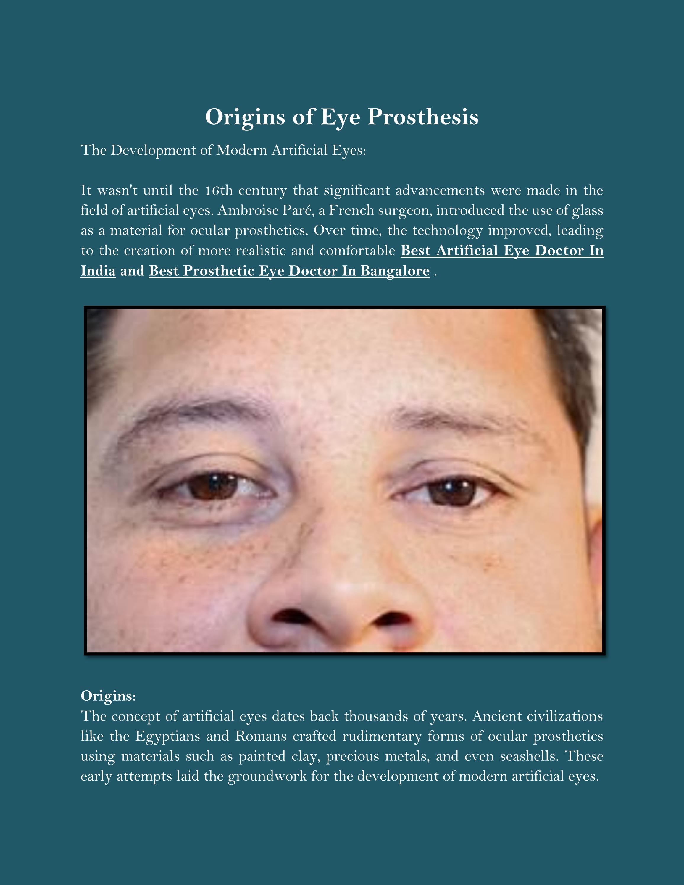 Origins of Eye Prosthesis by prostheticeyecenter Issuu