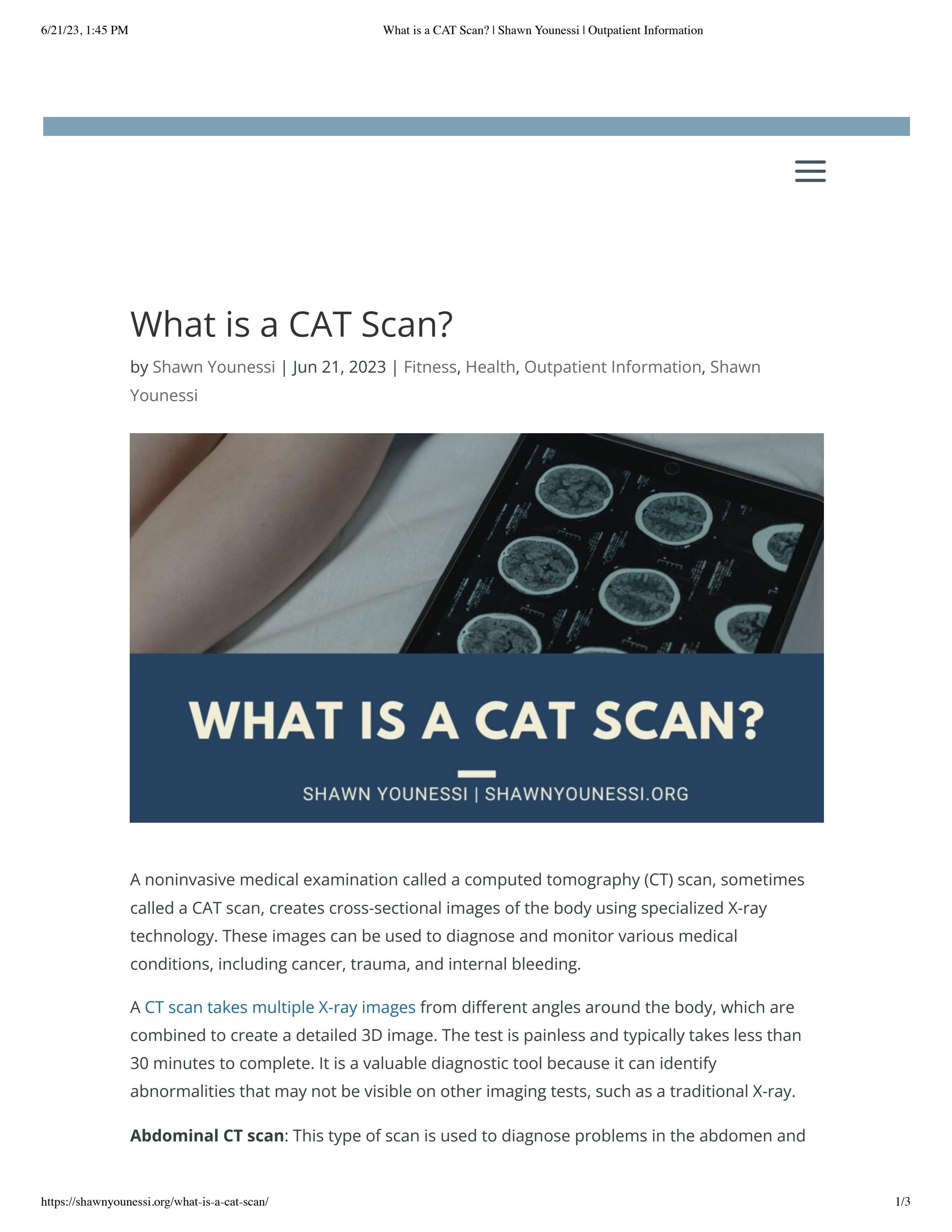 What is a CAT Scan? Shawn Younessi by Shawn Younessi Issuu