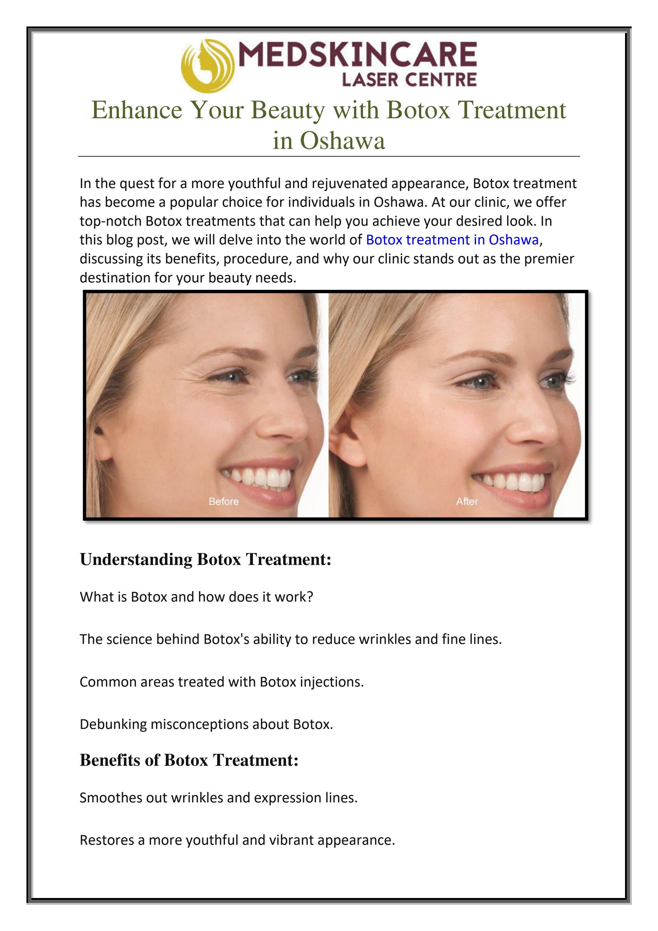 Enhance Your Beauty with Botox Treatment in Oshawa by Laser Hair