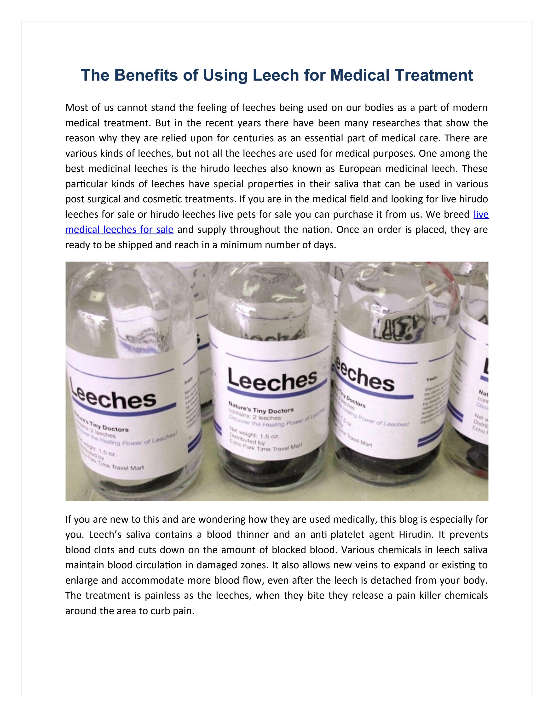 The Benefits of Using Leech for Medical Treatment by medicalleeches Issuu