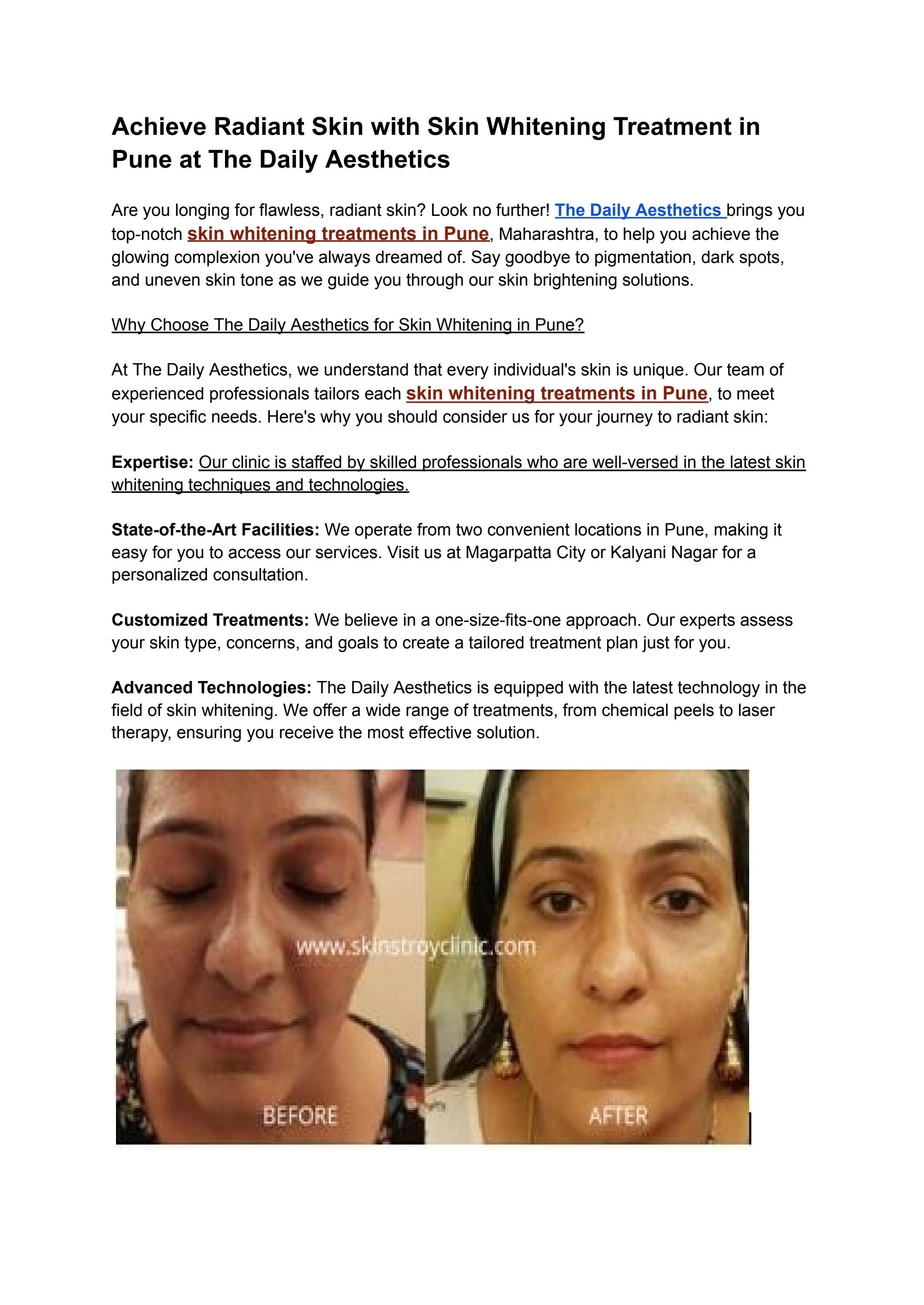 Skin Whitening Treatment in Pune at The Daily Aesthetics by Mona Shaha ...