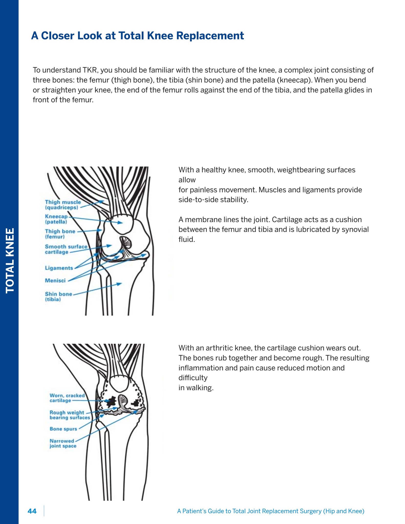 Pathway to Recovery: Patient Guide to Total Joint Replacement (Hip and ...