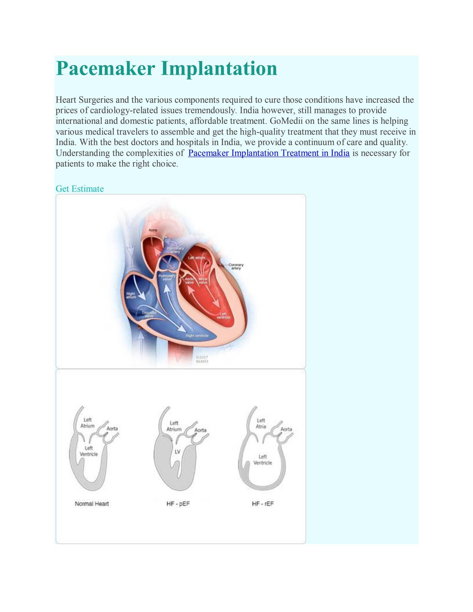 Pacemaker Implantation Surgery In India by patient care - Issuu