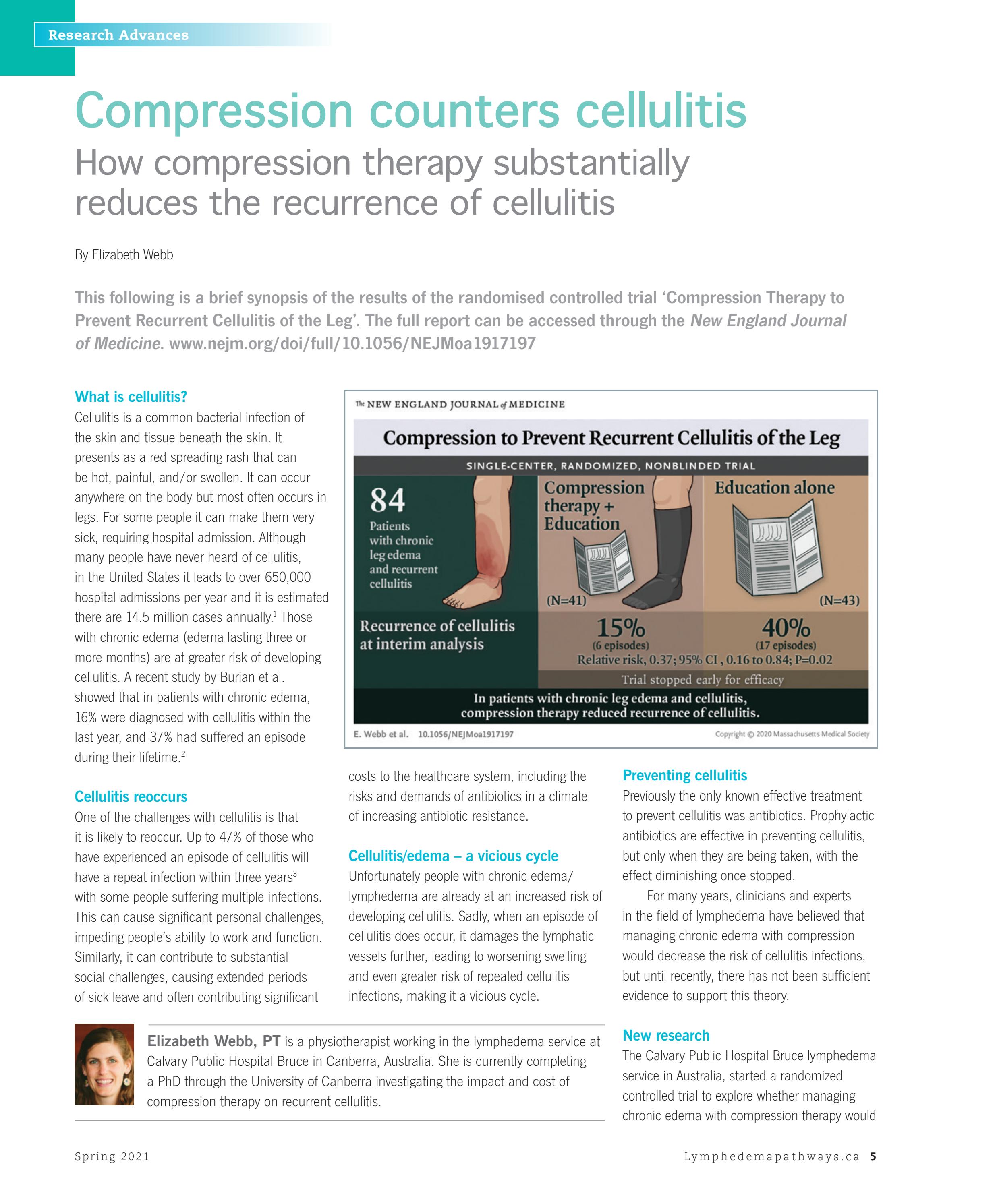 Compression counters cellulitis. E, b. Spring 2021 (Volume 10, Issue