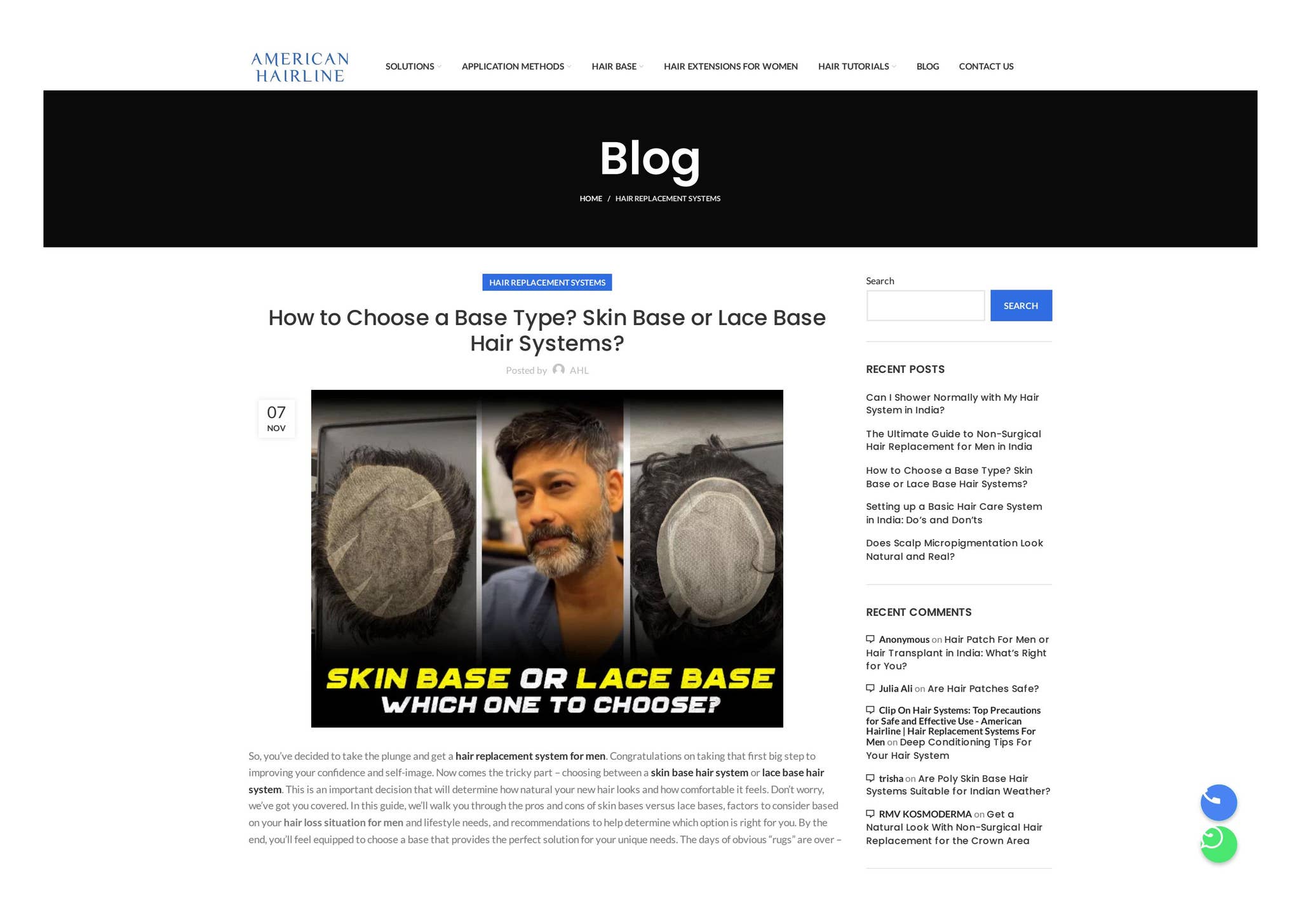 How to Choose a Base Type? Skin Base or Lace Base Hair Systems? by ...