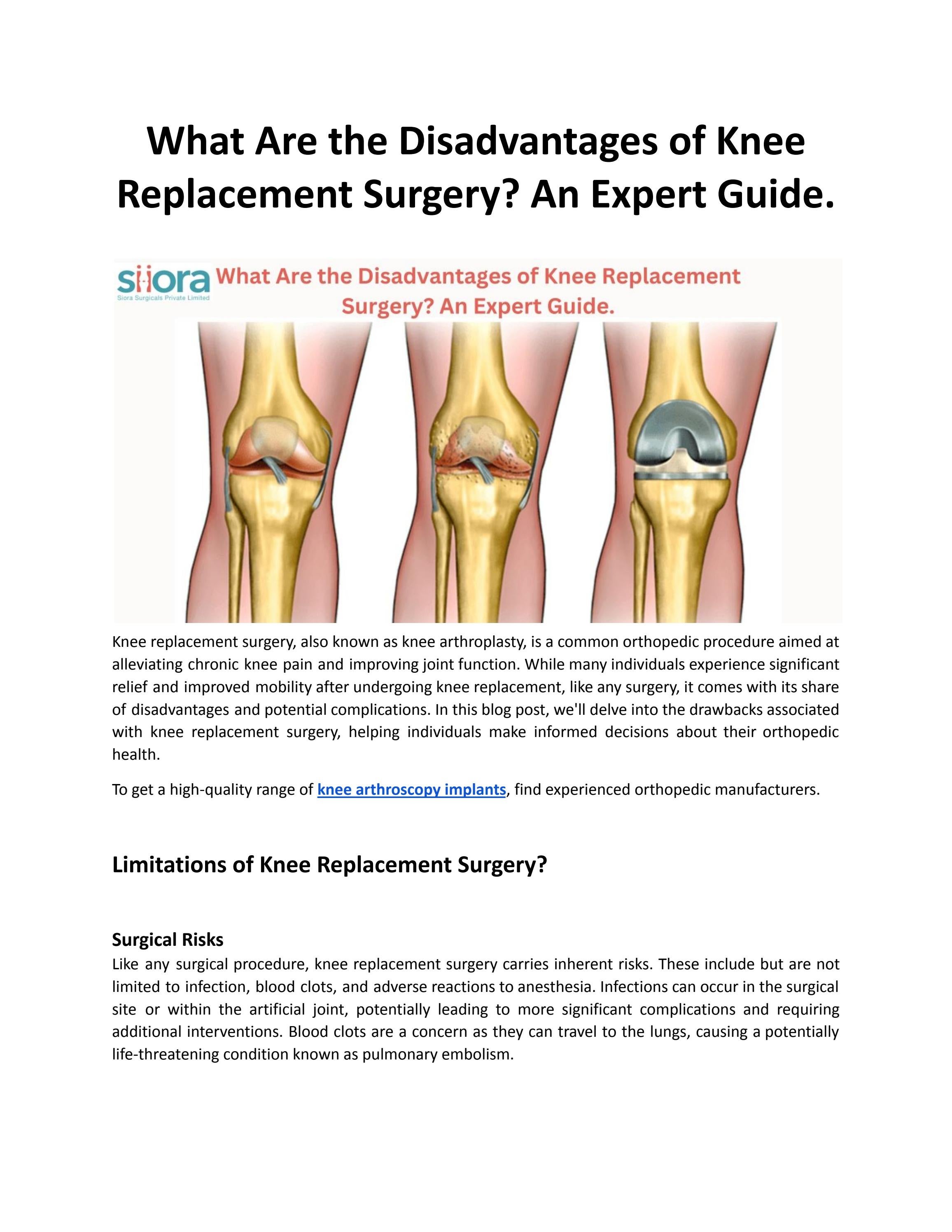 What Are the Disadvantages of Knee Replacement Surgery? An Expert Guide
