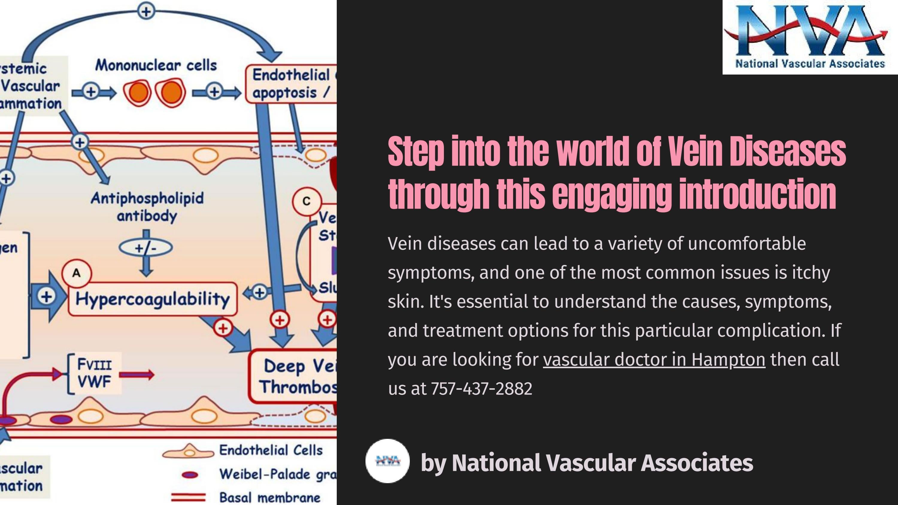 Step into the world of Vein Diseases through this engaging introduction ...
