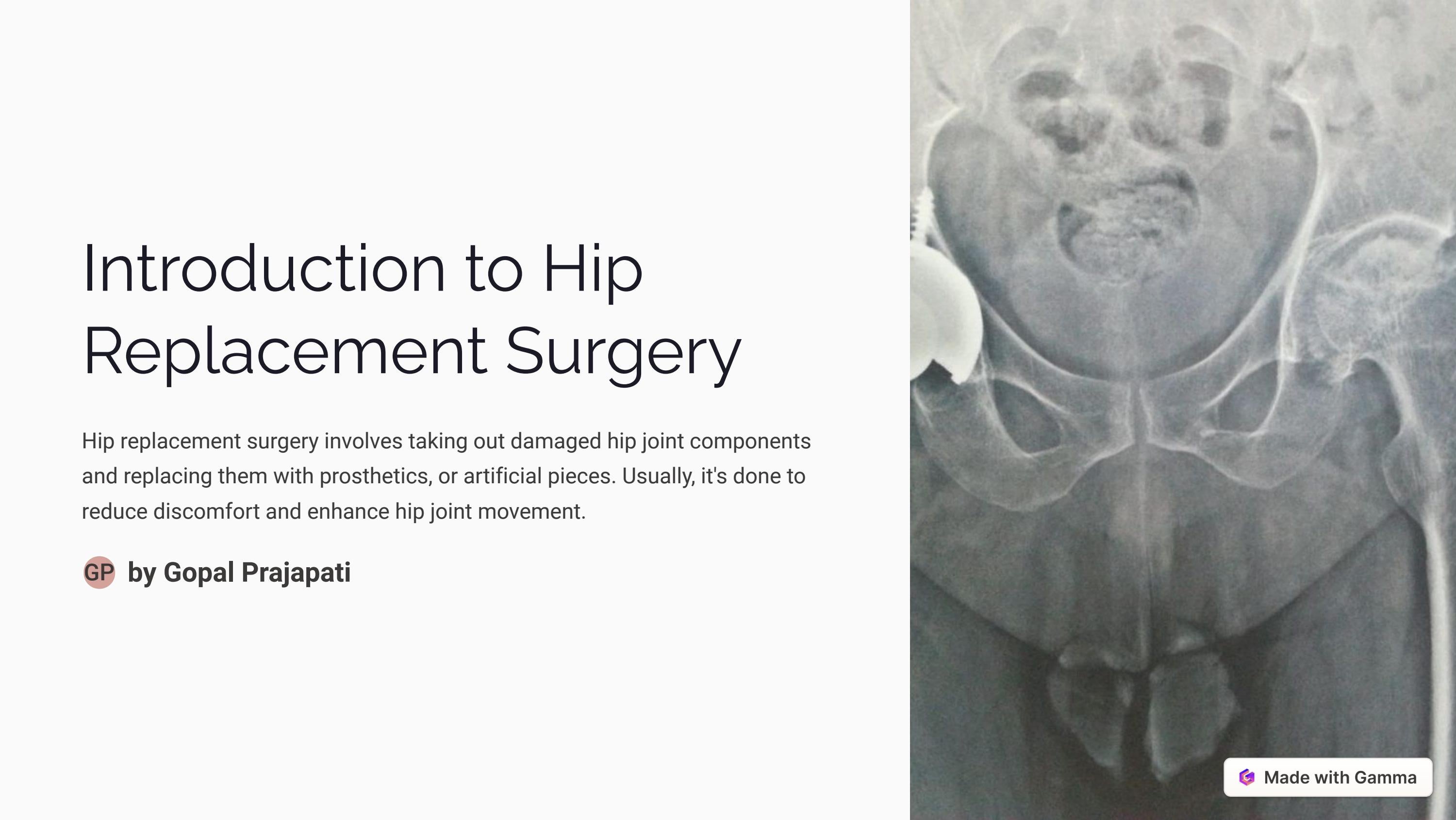 Best Hip Replacement Surgeon in Lucknow by Gopal Prajapati Issuu