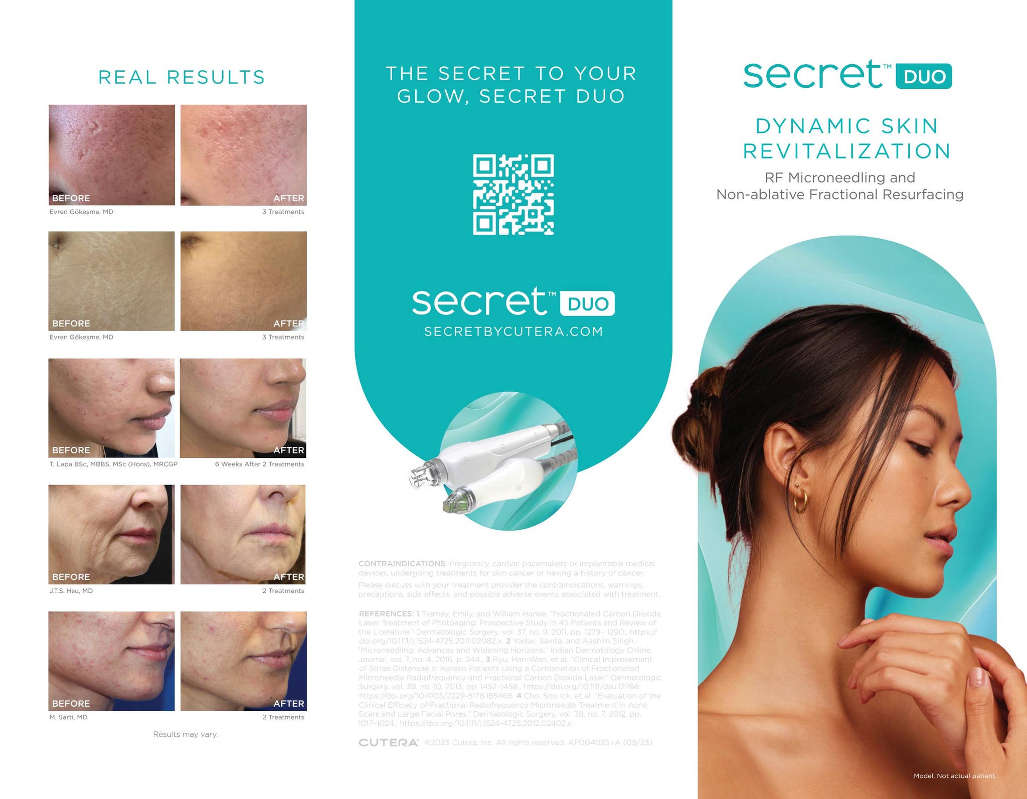 Secret DUO Patient Brochure by Cutera - Issuu