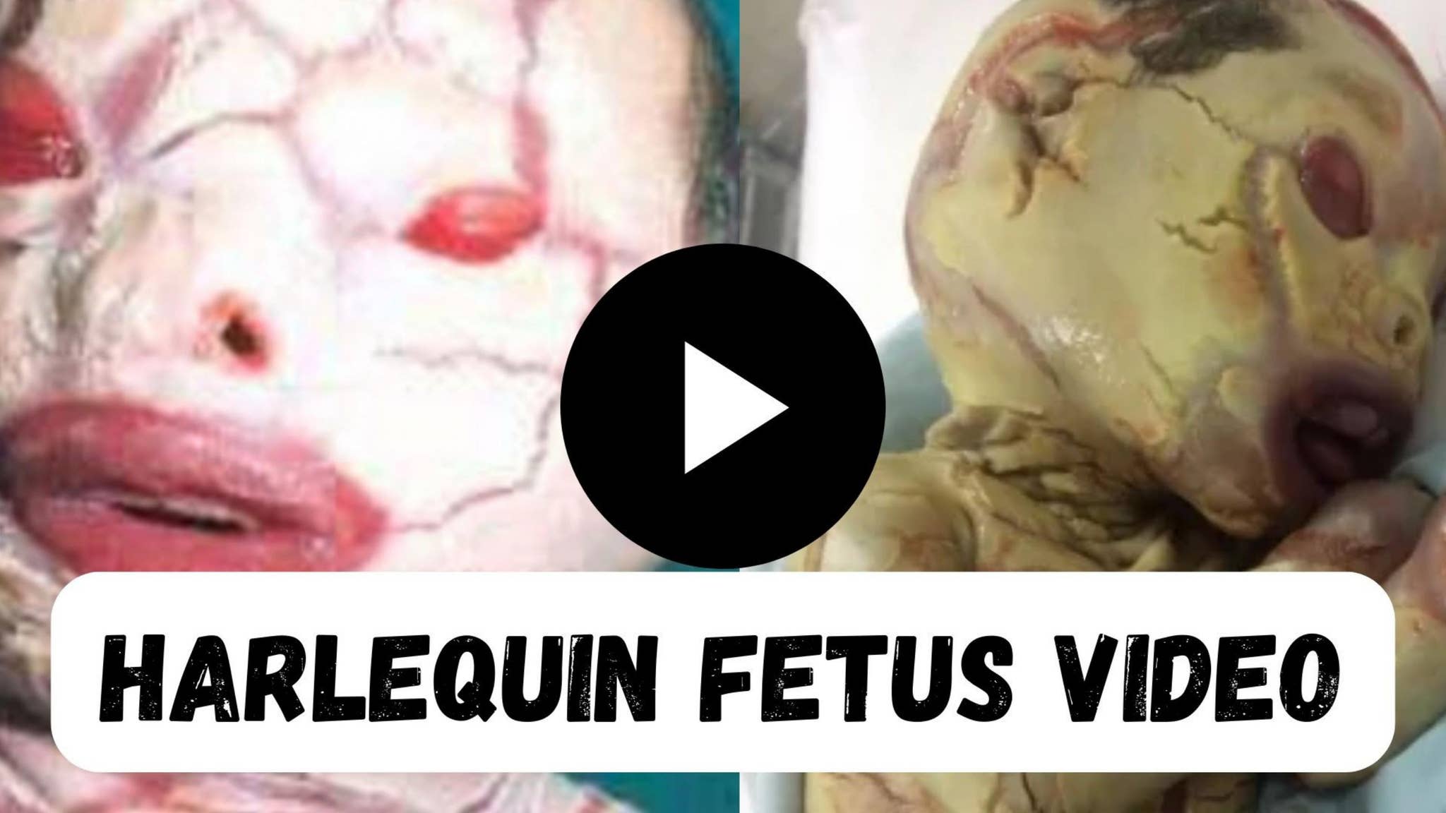 Harlequin Fetus Original Video by Денис Зубов - Issuu