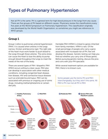 Navigating Pulmonary Hypertension: A 指南 for Newly Diagnosed Patients 第 12 页