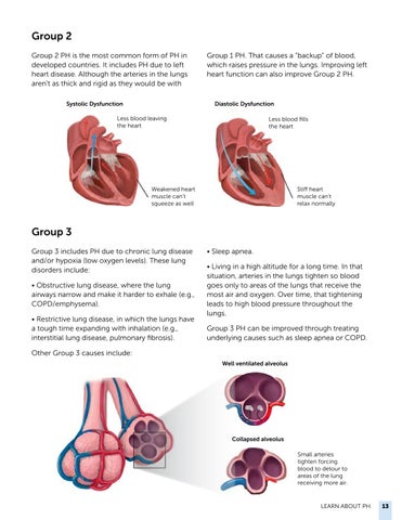 Navigating Pulmonary Hypertension: A 指南 for Newly Diagnosed Patients 第 13 页