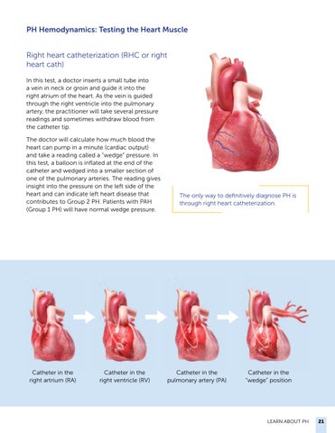 Navigating Pulmonary Hypertension: A 指南 for Newly Diagnosed Patients 第 21 页