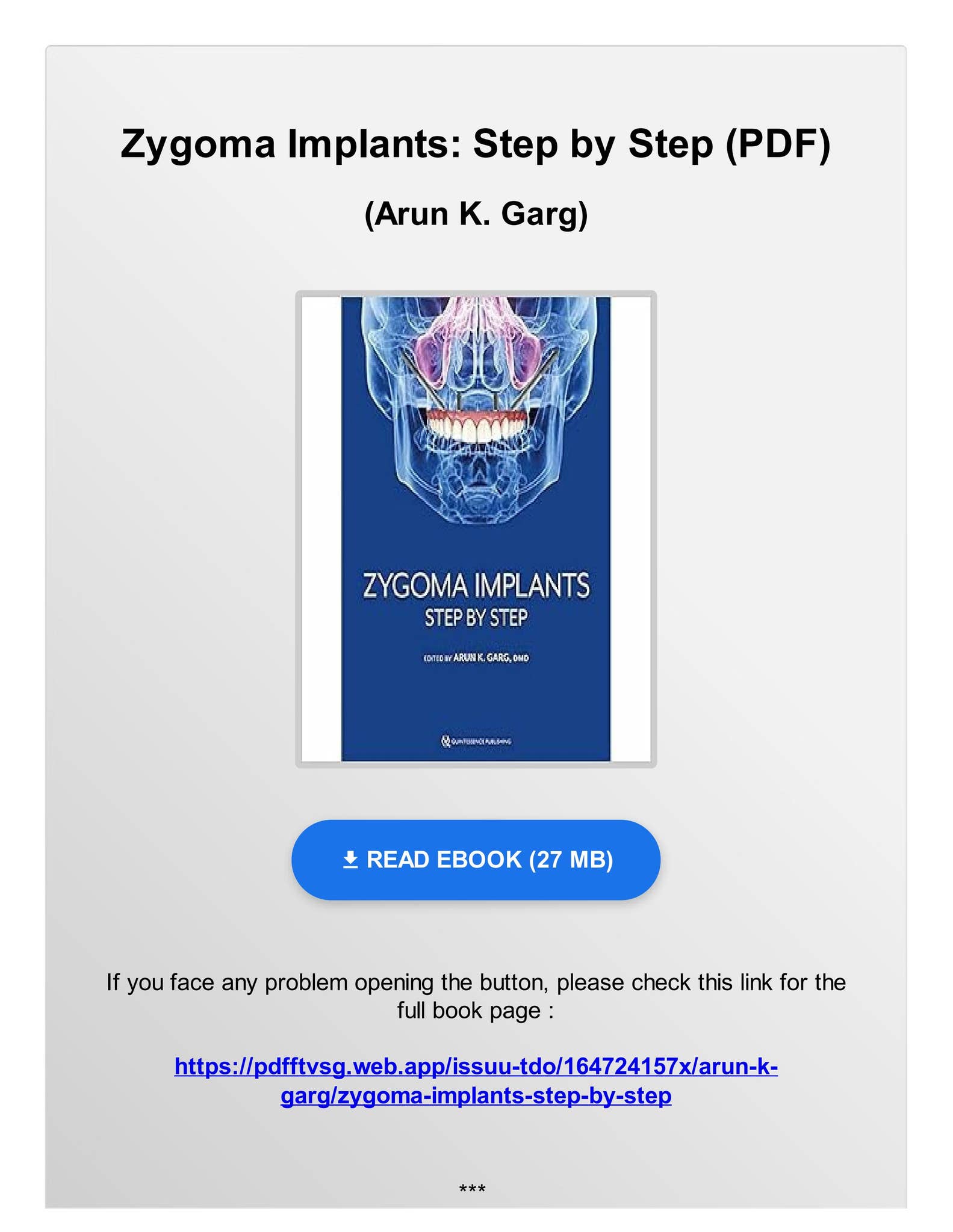 健康・医学 216 IMPLANTS Ultimate guide The Comprehensive Guide to Dental Implants - IMPLANT PERIO