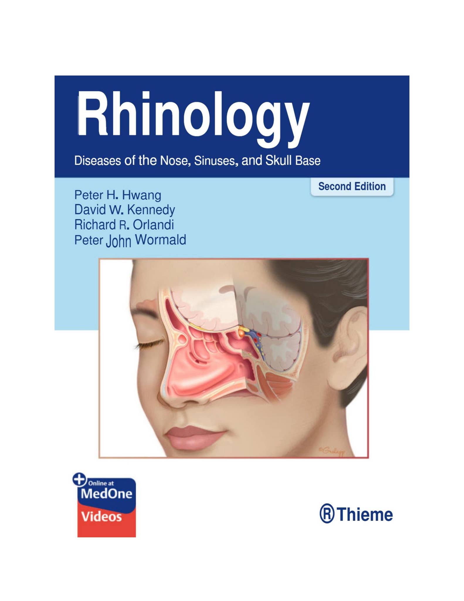 (eBook-PDF) Rhinology Diseases of the Nose, Sinuses, and Skull Base ...