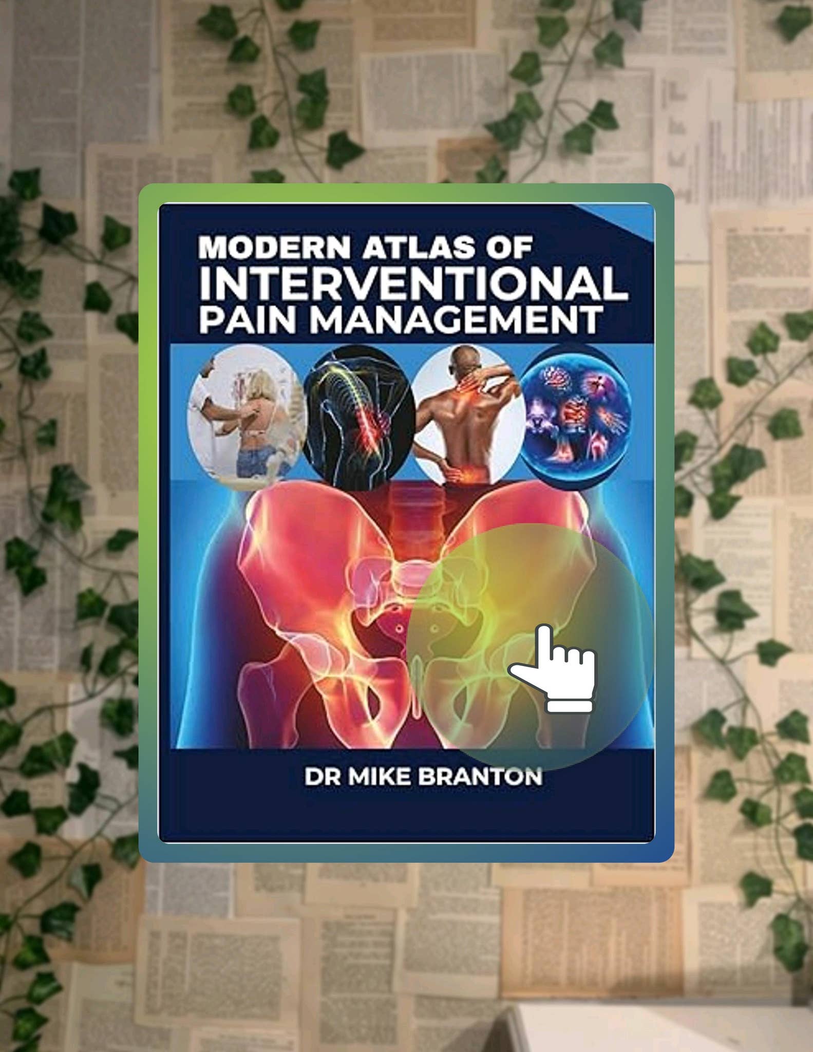 PDF Modern Atlas Of Interventional Pain Management: A Step-by-Step ...