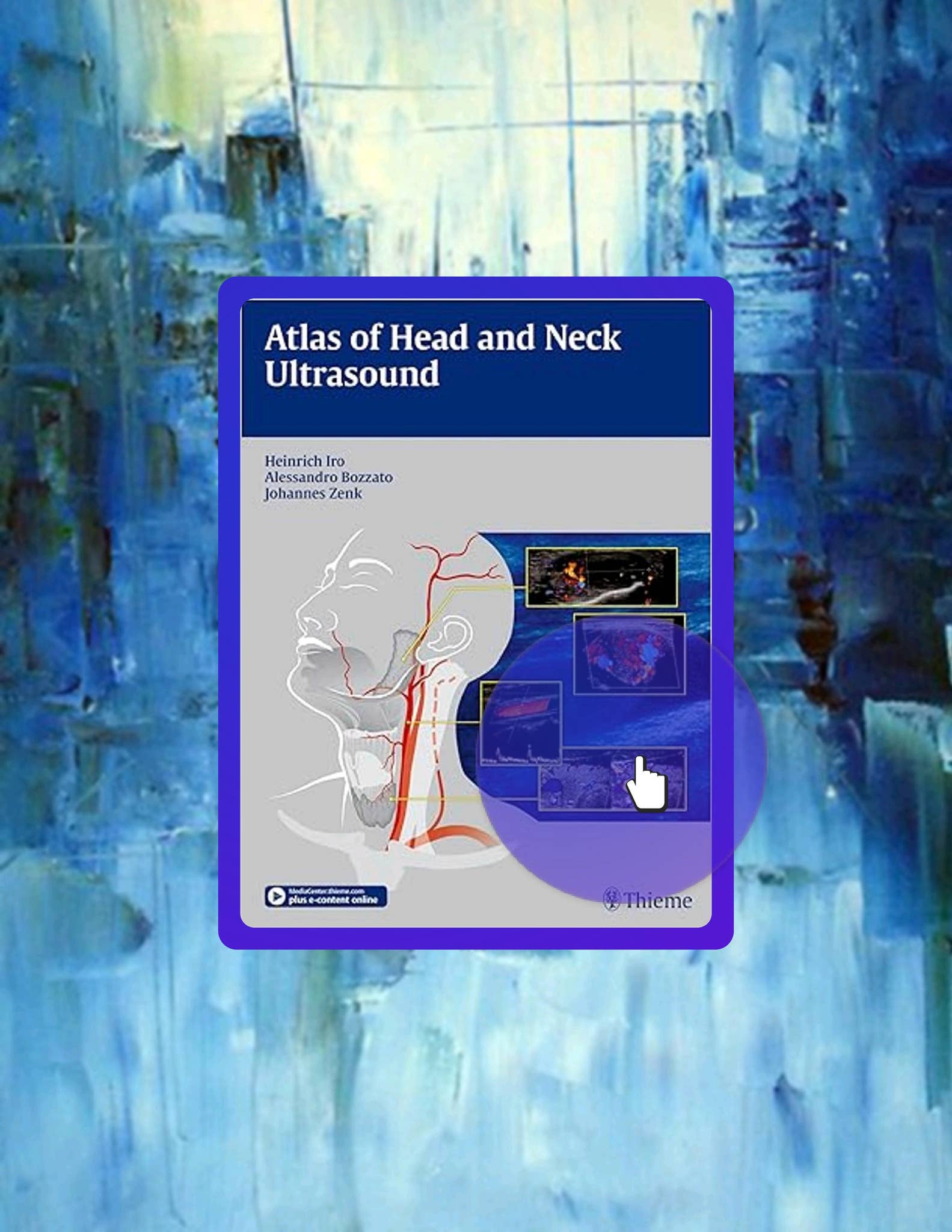 Grab Ebook Atlas of Head and Neck Ultrasound by Heinrich Iro by ...