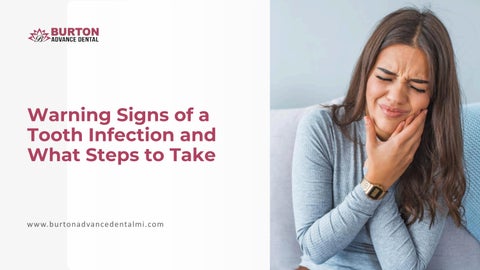 Warning Signs of a Tooth Infection and What Steps to Take by Burton ...