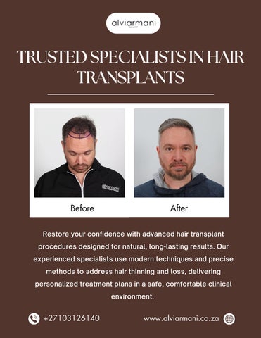 Trusted Specialists in Hair Transplants - Alvi Armani