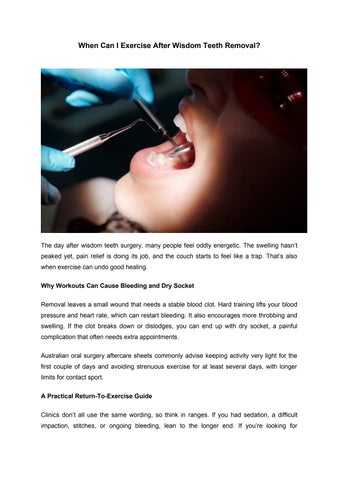When Can I Exercise After Wisdom Teeth Removal?