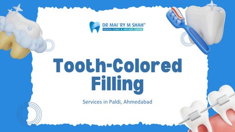 Tooth-Colored Filling Services Ahmedabad