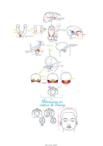 Desarrollo alterado del arco faríngeo sindrome de DiGeorge