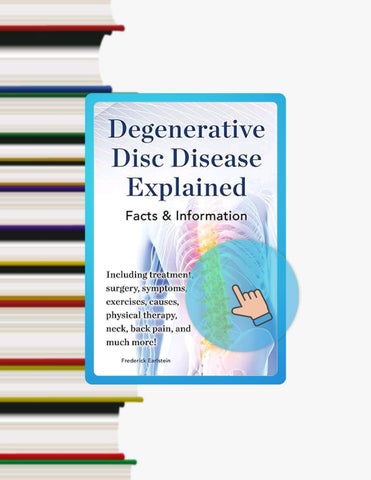 PDF Degenerative Disc Disease Explained. Including Treatment, Surgery ...