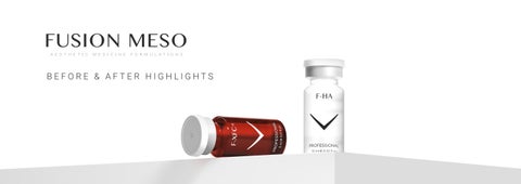 Fusion Mesotherapy Before & After Presentation