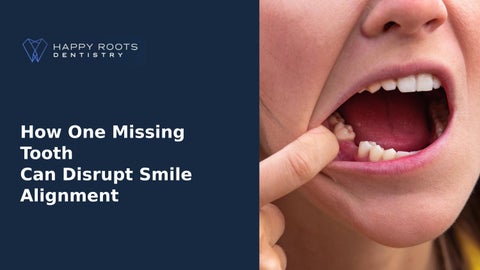 Know Why One Missing Tooth Can Shift Your Smile