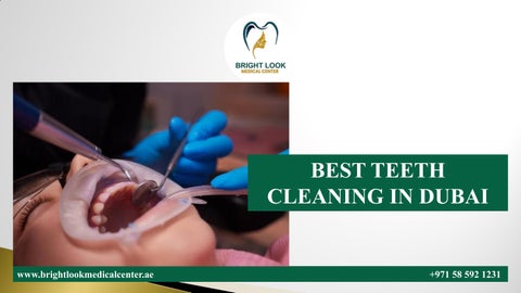 BEST TEETH CLEANING IN DUBAI