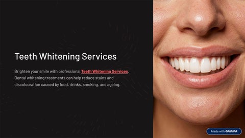 Teeth Whitening Services